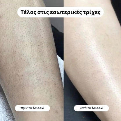 Ξυριστική Μηχανή Μπικίνι Smoovi 2.0