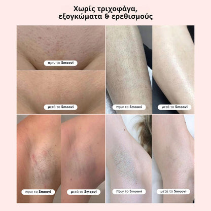 Ξυριστική Μηχανή Μπικίνι Smoovi 2.0