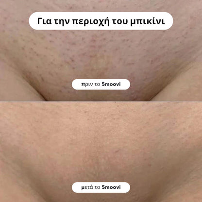 Ξυριστική Μηχανή Μπικίνι Smoovi 2.0