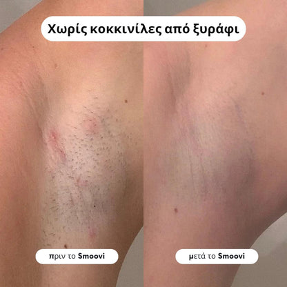 Ξυριστική Μηχανή Μπικίνι Smoovi 2.0