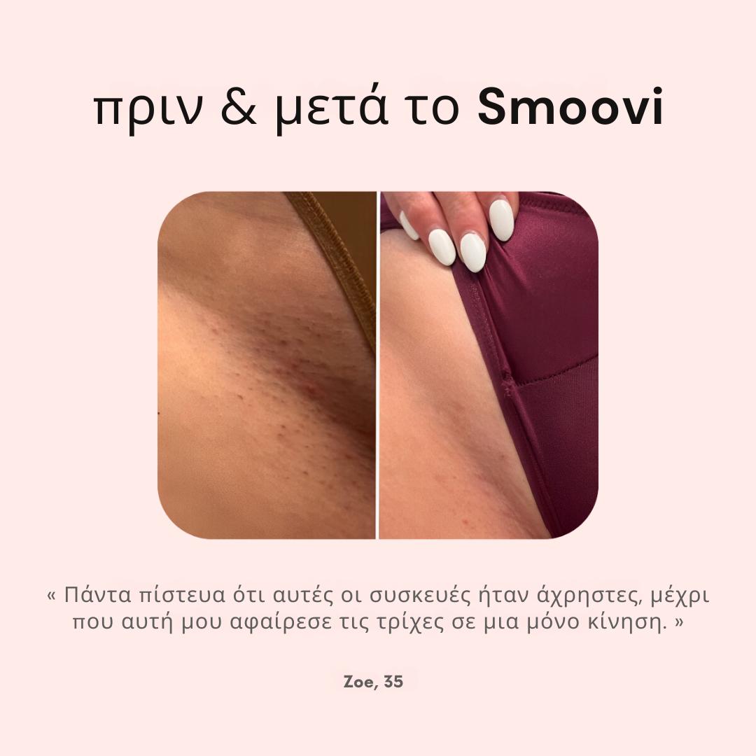 Ξυριστική Μηχανή Μπικίνι Smoovi 2.0